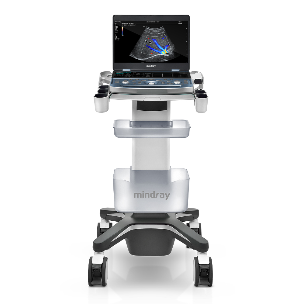 Ultrassom MX7 | Safe Suporte à Vida Ultrassom MX7 | Safe Suporte à Vida